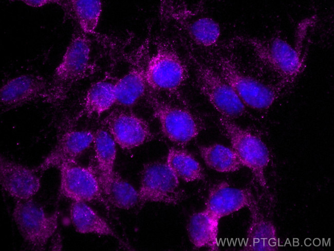 UCHL1/PGP9.5 Antibody in Immunocytochemistry (ICC/IF)