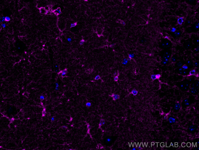 Glutamine Synthetase Antibody in Immunohistochemistry (PFA fixed) (IHC (PFA))