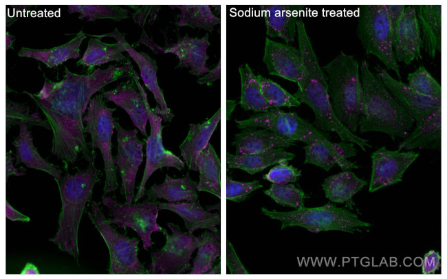 G3BP1 Antibody in Immunocytochemistry (ICC/IF)