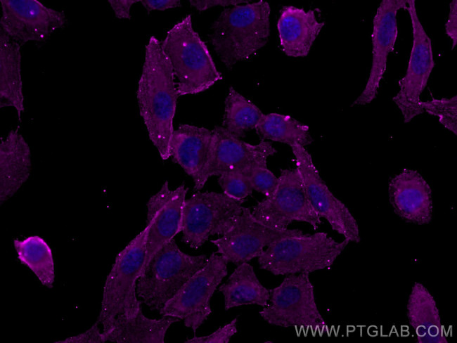 Phospho-RIPK1 (Ser161) Antibody in Immunocytochemistry (ICC/IF)