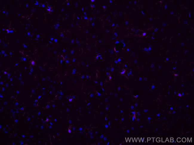 IBA1 Antibody in Immunohistochemistry (PFA fixed) (IHC (PFA))