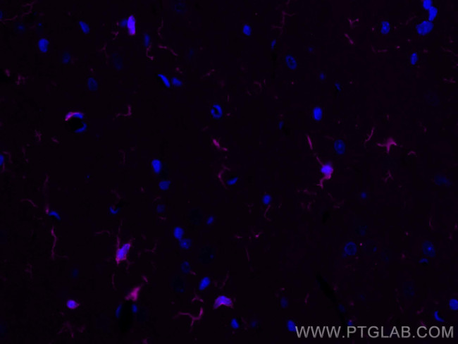 IBA1 Antibody in Immunohistochemistry (PFA fixed) (IHC (PFA))