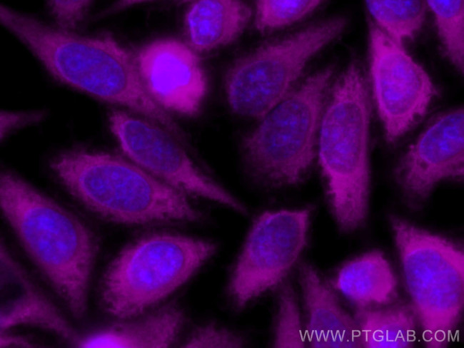 Spartin, SPG20 Antibody in Immunocytochemistry (ICC/IF)