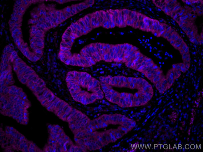 Amphiregulin Antibody in Immunohistochemistry (Paraffin) (IHC (P))