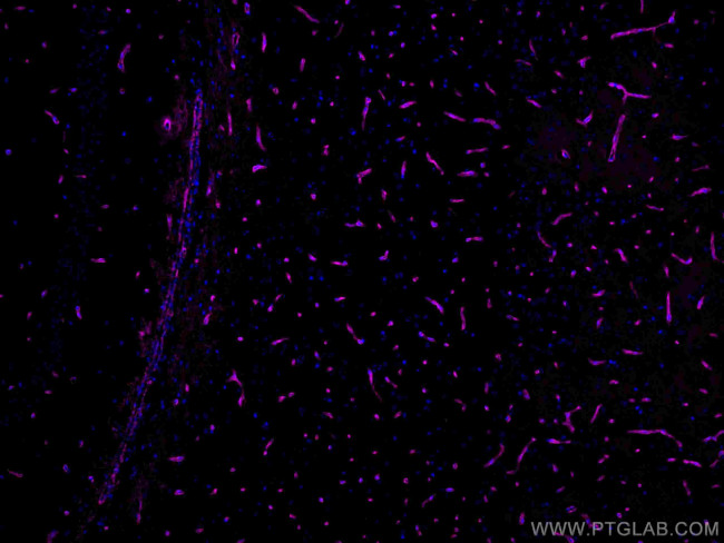 Aquaporin 4 Antibody in Immunohistochemistry (Paraffin) (IHC (P))