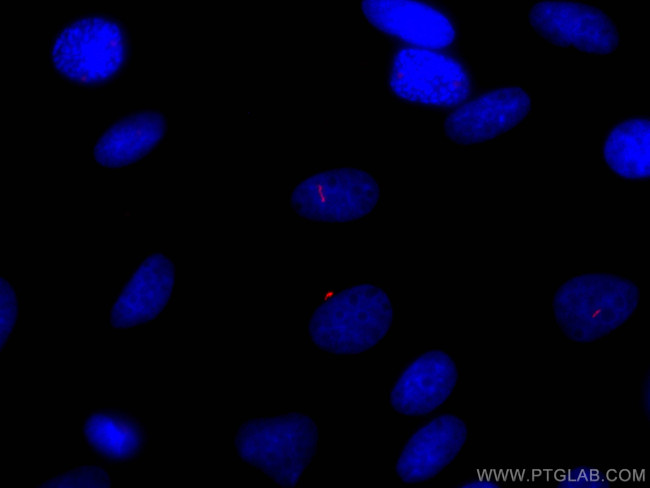 ARL13B Antibody in Immunocytochemistry (ICC/IF)