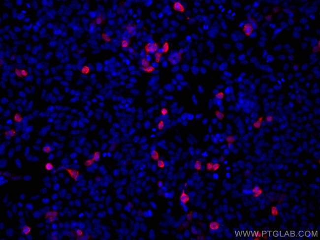 MYC tag Antibody in Immunocytochemistry (ICC/IF)