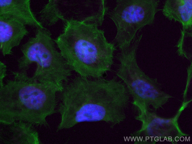 HDAC1 Antibody in Immunocytochemistry (ICC/IF)