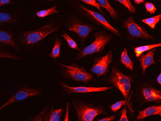 Cytokeratin 18 Antibody in Immunocytochemistry (ICC/IF)