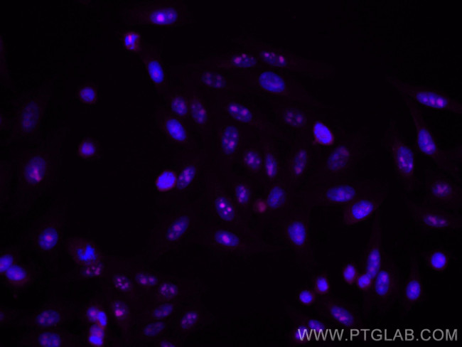 IMP3 Antibody in Immunocytochemistry (ICC/IF)