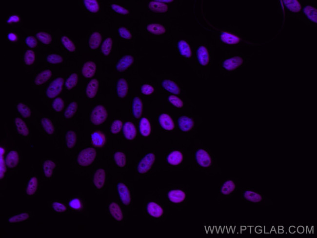 KAP1 Antibody in Immunocytochemistry (ICC/IF)