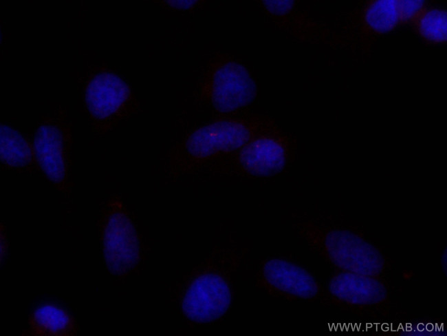 ARL13B Antibody in Immunocytochemistry (ICC/IF)