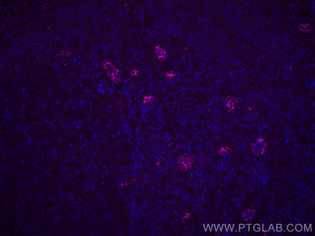 Endoglin/CD105 Antibody in Immunohistochemistry (Paraffin) (IHC (P))