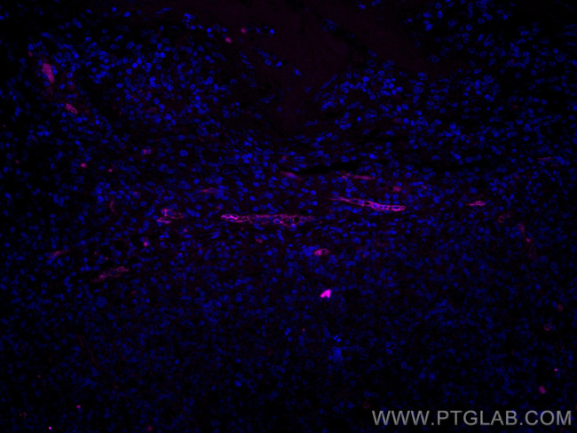 Endoglin/CD105 Antibody in Immunohistochemistry (Paraffin) (IHC (P))