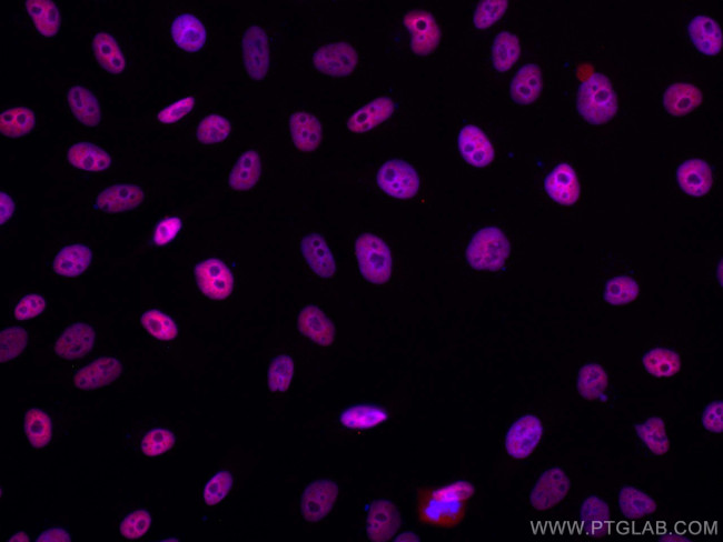 HDAC2 Antibody in Immunocytochemistry (ICC/IF)