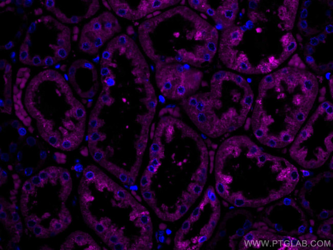 ERP29 Antibody in Immunohistochemistry (Paraffin) (IHC (P))