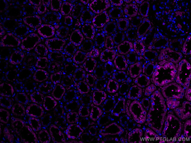 ERP29 Antibody in Immunohistochemistry (Paraffin) (IHC (P))