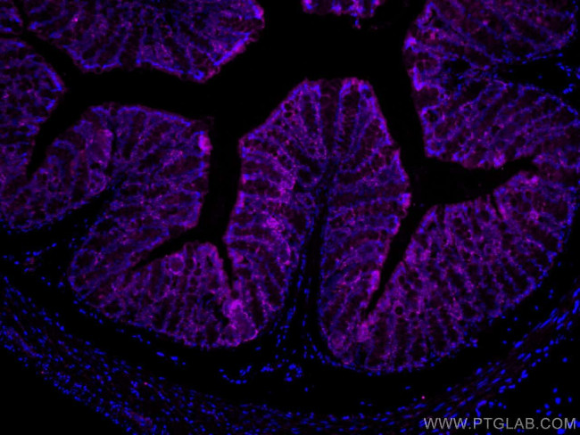 FABP2 Antibody in Immunohistochemistry (Paraffin) (IHC (P))