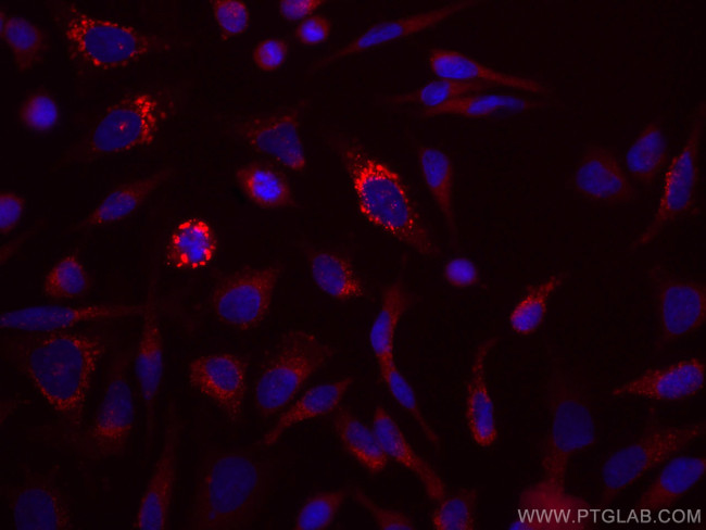 EPRS Antibody in Immunocytochemistry (ICC/IF)