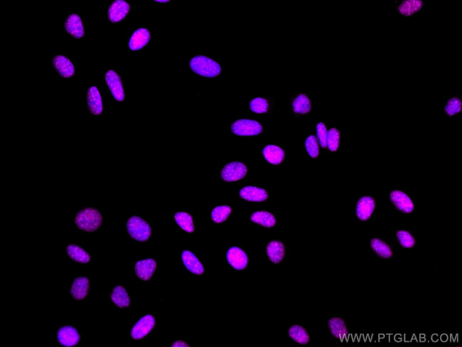 EIF4A3 Antibody in Immunocytochemistry (ICC/IF)