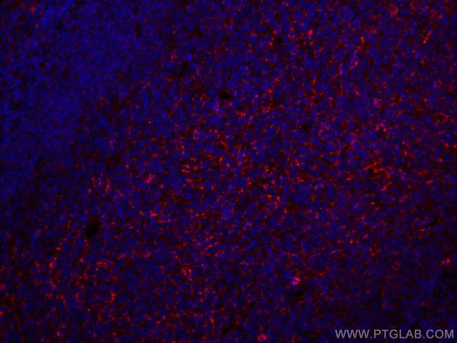 CD70 Antibody in Immunohistochemistry (Paraffin) (IHC (P))