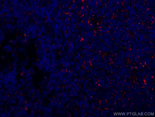 CD70 Antibody in Immunohistochemistry (Paraffin) (IHC (P))