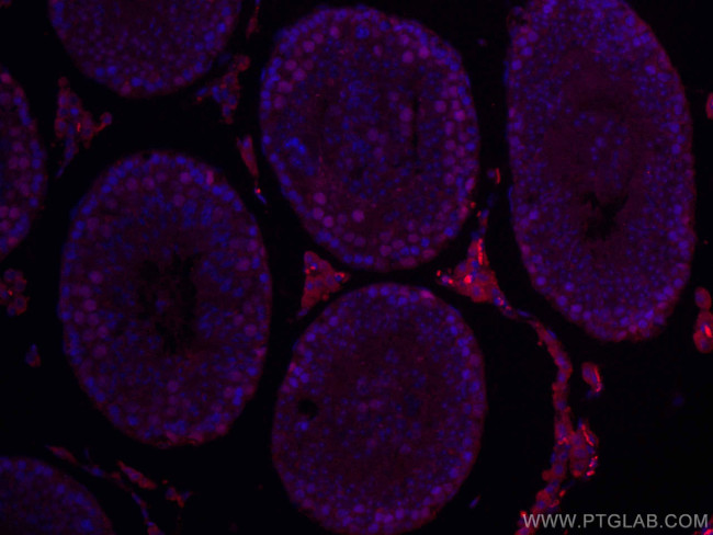 EED Antibody in Immunohistochemistry (Paraffin) (IHC (P))