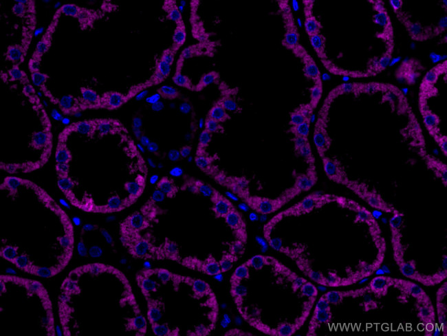 AIF Antibody in Immunohistochemistry (Paraffin) (IHC (P))