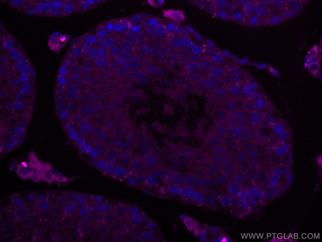 SMCR7L Antibody in Immunohistochemistry (Paraffin) (IHC (P))