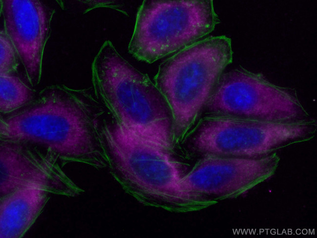 LARP1 Antibody in Immunocytochemistry (ICC/IF)