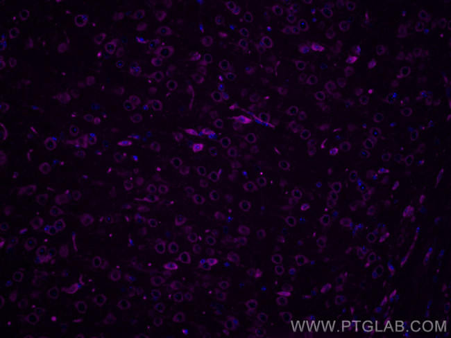 FXR1 Antibody in Immunohistochemistry (Paraffin) (IHC (P))