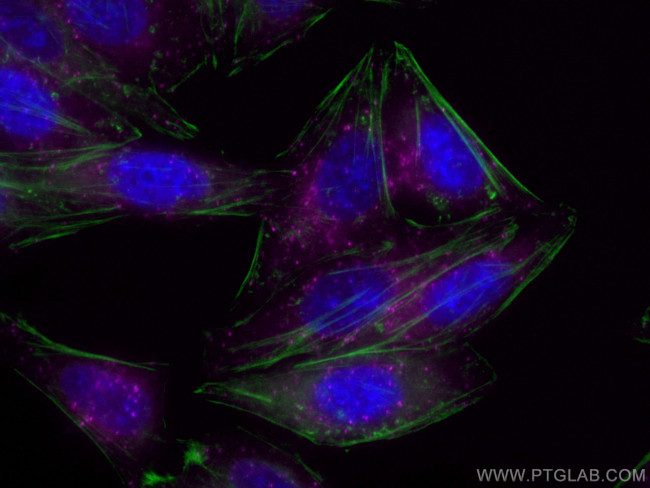 HGS Antibody in Immunocytochemistry (ICC/IF)