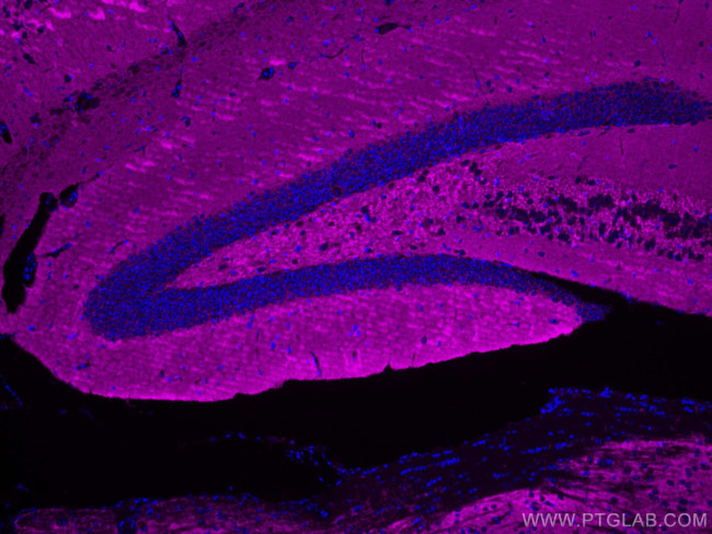 Synaptophysin Antibody in Immunohistochemistry (Paraffin) (IHC (P))