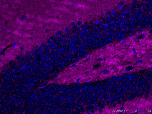 Synaptophysin Antibody in Immunohistochemistry (Paraffin) (IHC (P))