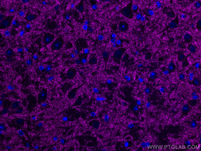 Synaptophysin Antibody in Immunohistochemistry (Paraffin) (IHC (P))