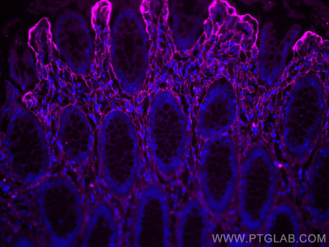 Collagen Type III Antibody in Immunohistochemistry (Paraffin) (IHC (P))