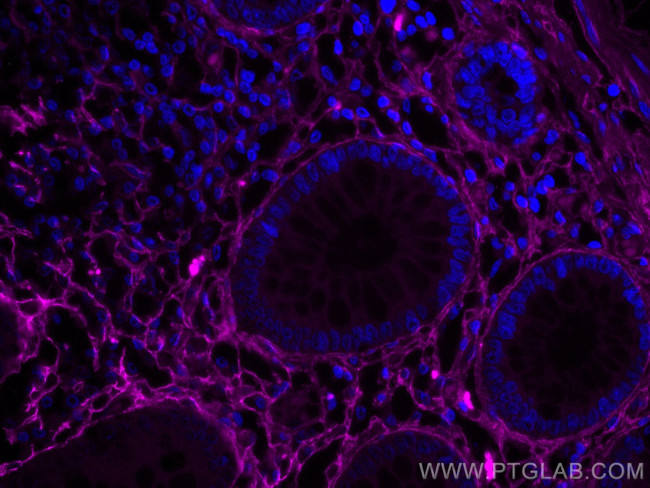 Collagen Type III Antibody in Immunohistochemistry (Paraffin) (IHC (P))