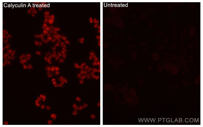 Phospho-STK11 (Thr189) Antibody in Immunocytochemistry (ICC/IF)