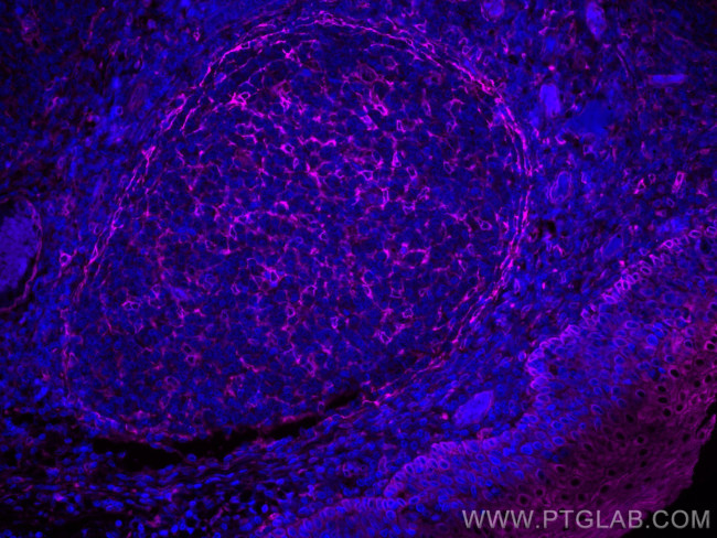 TMEM173/STING Antibody in Immunohistochemistry (Paraffin) (IHC (P))