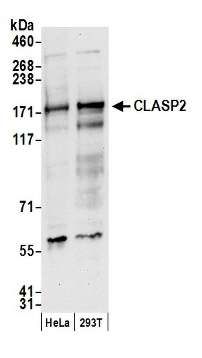 CLASP2 Antibody in Western Blot (WB)