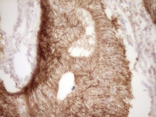 CLDN3 Antibody in Immunohistochemistry (Paraffin) (IHC (P))