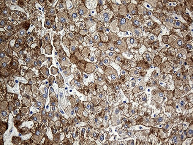 CLEC10A Antibody in Immunohistochemistry (Paraffin) (IHC (P))