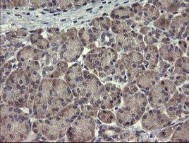 CLEC4E Antibody in Immunohistochemistry (Paraffin) (IHC (P))