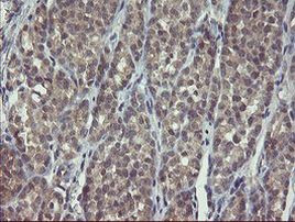 CLEC4E Antibody in Immunohistochemistry (Paraffin) (IHC (P))