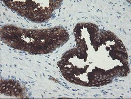 CLEC4E Antibody in Immunohistochemistry (Paraffin) (IHC (P))