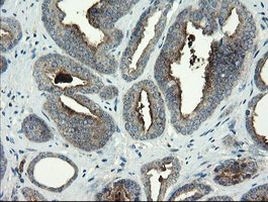 CLEC4E Antibody in Immunohistochemistry (Paraffin) (IHC (P))