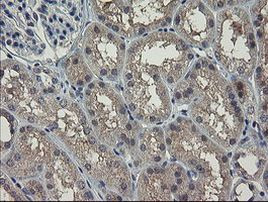 CLEC4E Antibody in Immunohistochemistry (Paraffin) (IHC (P))