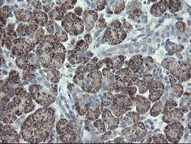 CLEC4E Antibody in Immunohistochemistry (Paraffin) (IHC (P))