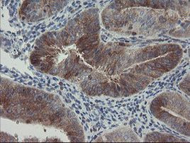 CLEC4E Antibody in Immunohistochemistry (Paraffin) (IHC (P))