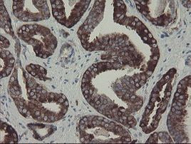 CLEC4E Antibody in Immunohistochemistry (Paraffin) (IHC (P))